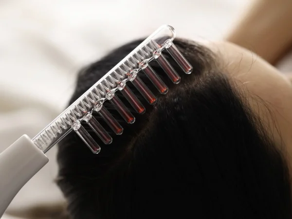 Radiofrequência Microagulhada