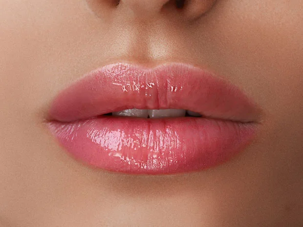 Preenchimento Labial