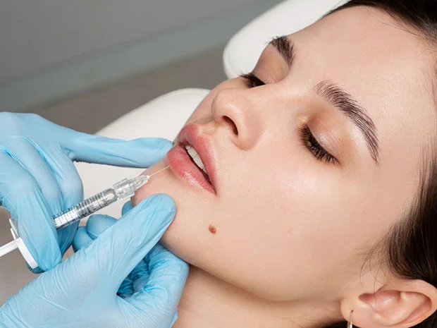 Preenchimento Labial